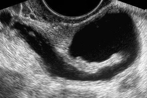 Dr Jasdev Singh fertility services in Kuala Lumpur